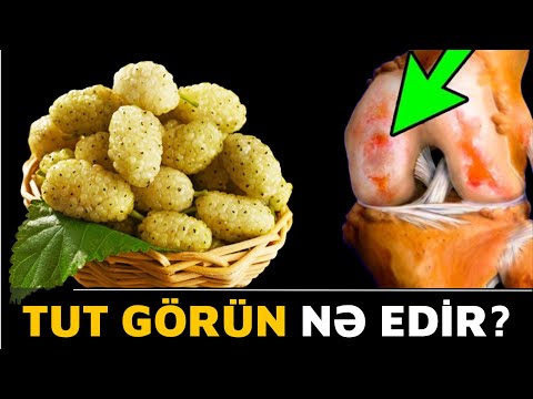 Video: Banan dəmirin udulmasına mane olurmu?