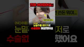 눈밑주름레이저 세로 유진