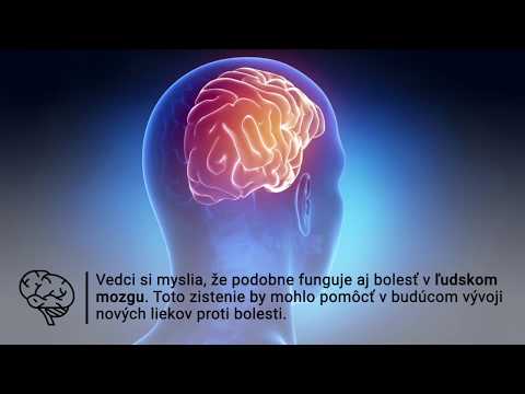 Video: Vedci Pochopili, Odkiaľ Pochádzajú Záhadné Magnetické Gule V Mozgu. Alternatívny Pohľad