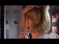 Trichotillomania: Why These Women Rip Out Their Own Hair