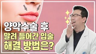 [Q&amp;A] 양잘알 서백건 탐방기 4편! 양악수술 후 인중과 입술 변화를 해결하는 방법!