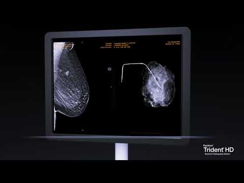 Faxitron® Trident® HD Specimen Radiography System