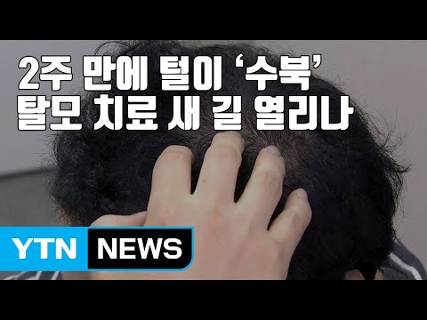   자막뉴스 2주 만에 털이 수북 탈모 치료 새 길 열리나 YTN