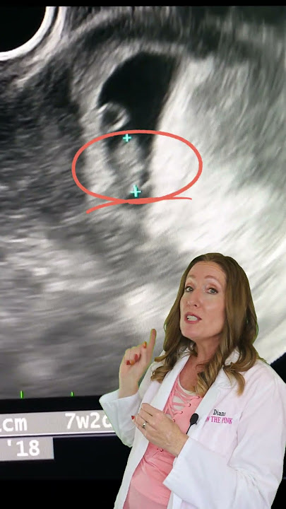 Can you HEAR the Heartbeat on a 7 Week Ultrasound?