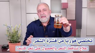 خلطة قوية وسريعة لتقوية جذور الشعر والحصول على شعر كثيف خالي من القشرة و التقصف