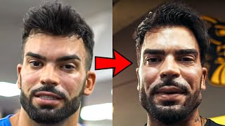 Famous Sergi Constance Pulled A Zac Efron? Profile