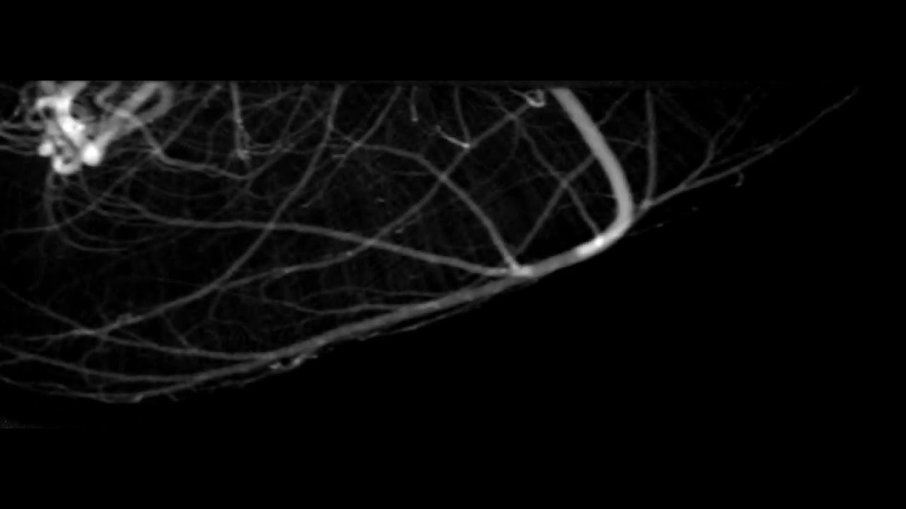 Real-time X-ray imaging of mouse cerebral microvessels