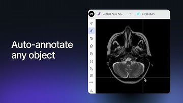 V7 for Medical Image Annotation & Model Training