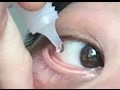 How to use eye drops properly.