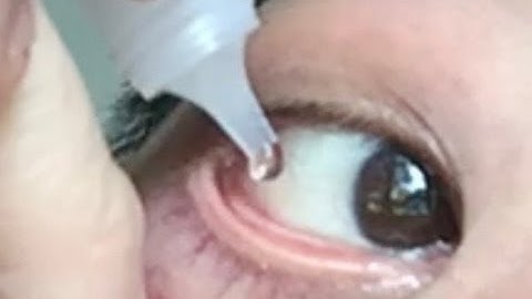 How to use eye drops properly. How to put eyedrops in your own eyes.