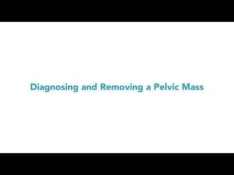Overview of open surgery for pelvic mass