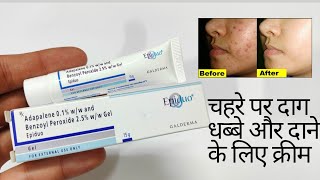 Epiduo Gel Acne Treatment Gel Reduce Acne Resimi