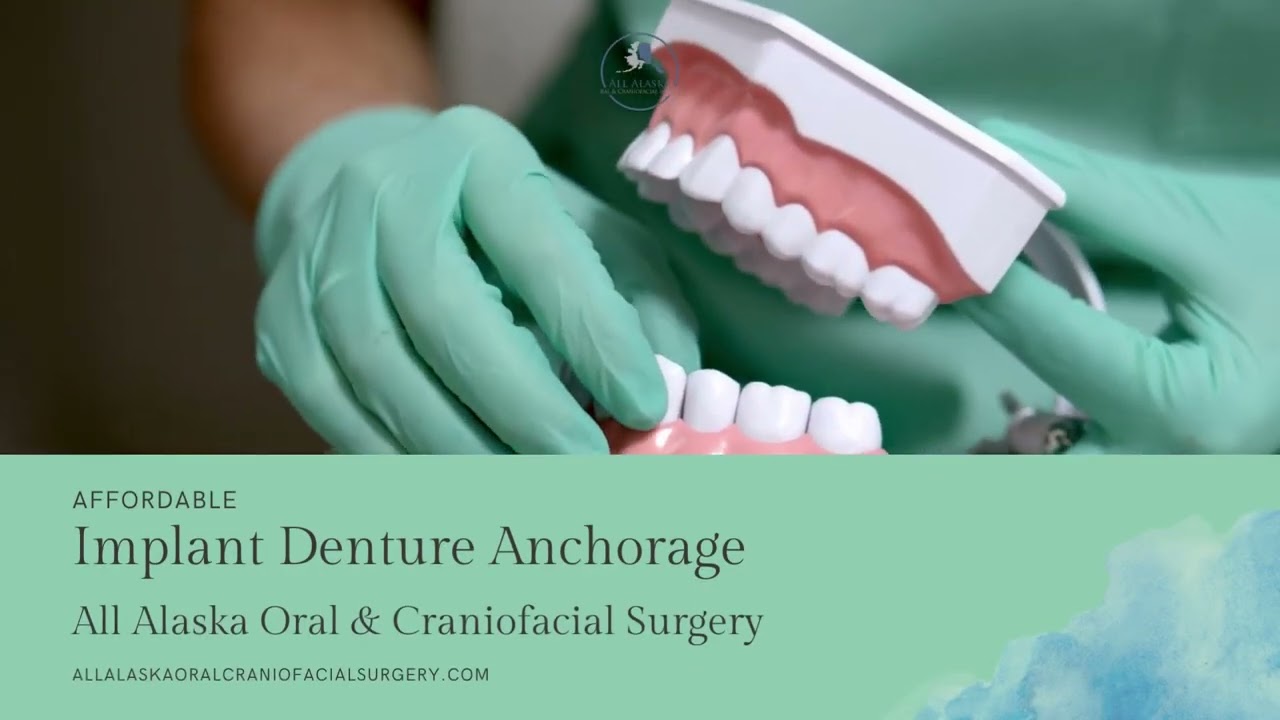 Affordable Implant Denture Anchorage