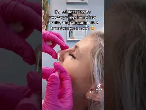 Video: Kaip padaryti, kad nosis būtų mažiau gumbuota?