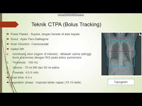 Prosedur/teknik CTA PULMONARY Embolism