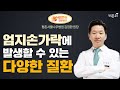 엄지손가락에 발생할 수 있는 다양한 질환 평촌서울나우병원 김정환 원장 평촌서울나우병원 라이브 엄지손가락에 발생할 수 있는 다양한 질환 평촌서울나우병원 김정환 원장 평촌서울나우병원 라이브