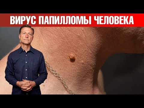 Вирус папилломы человека (ВПЧ)? Попробуйте это...