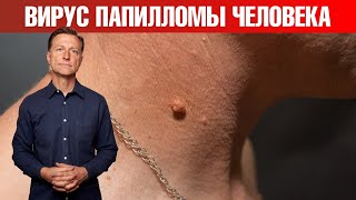 Вирус папилломы человека (ВПЧ)? Попробуйте это...