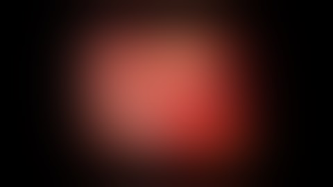 laparoscopic gallbladder surgery and removal of scar tissue (Adheshiolysis)