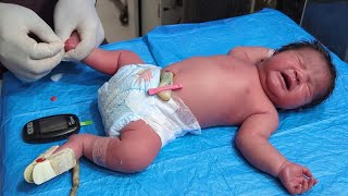 Idm Overweight Baby Essment Macrosomic Infant Of Diabetic Mother