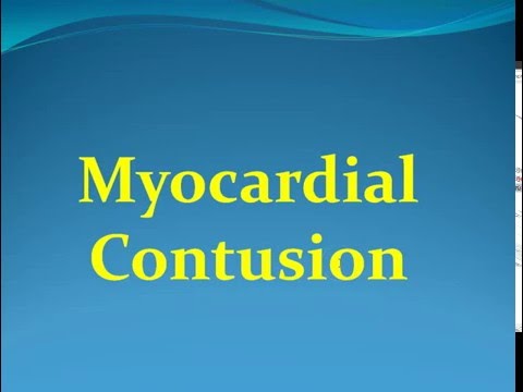 Surgery 19 Chest Trauma 4 Myocardial Contusion