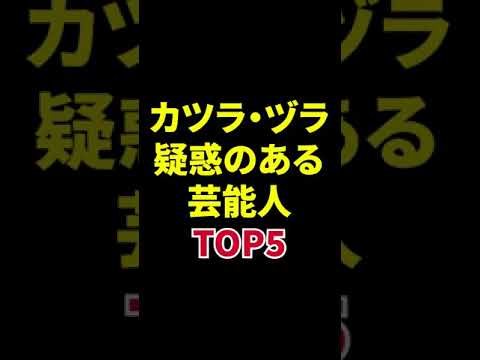 カツラ・ヅラ疑惑のある芸能人TOP5 #shorts