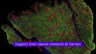 Liver cancer | Support Garvan's research today