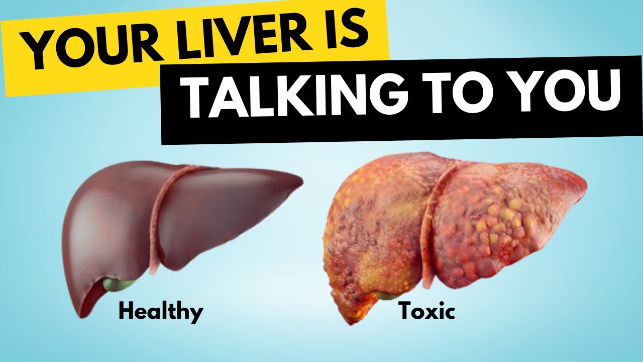 How To Naturally Clean Out The Liver | Easy And Fast Way to Detox | Health Tips