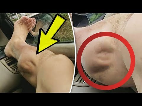 12-ways-to-get-rid-of-leg-cramps-forever-|-leg-cramp-remedies-|-leg-cramps-causes-and-cures-|