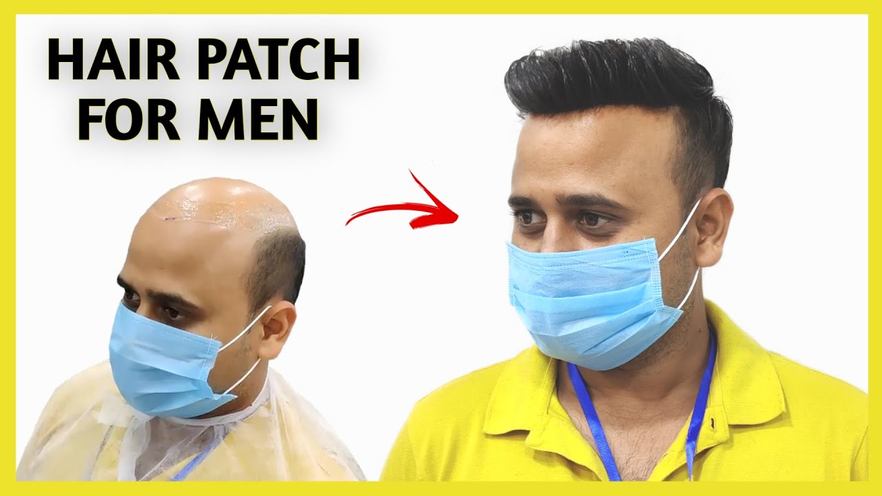 Hair patch for men Natural looking hair patch for men in Delhi🔥 YouTube