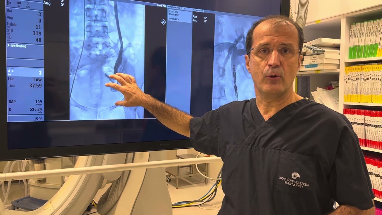 Pelvik konjesyon sendromu ve embolizasyon tedavisi