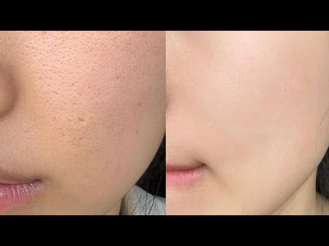 Experimental Textureless Baby Skin ୨୧ Deep Exfoliation 1X