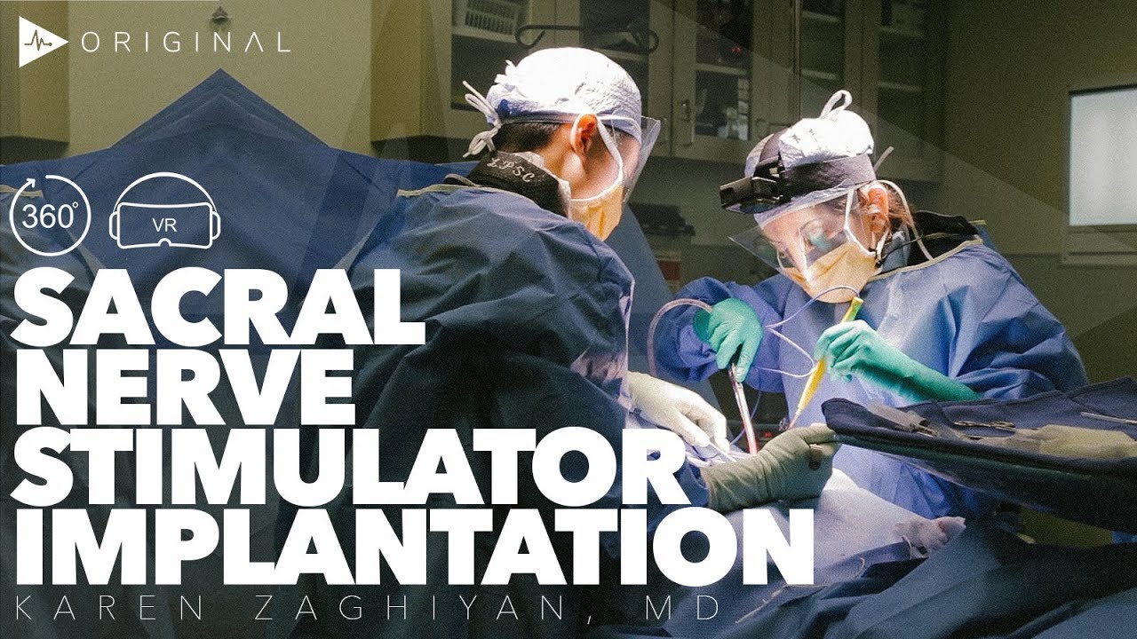 Sacral Nerve Stimulator Implantation Dr. Karen Zaghiyan YouTube