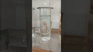 Preserved Foetuses and Placenta | Museum specimens