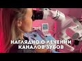 Наглядно о лечении каналов зубов: как работает терапевт-эндодонтист под микроскопом
