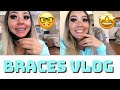 GETTING MY BRACES OFF VLOG ( THE PROCESS )