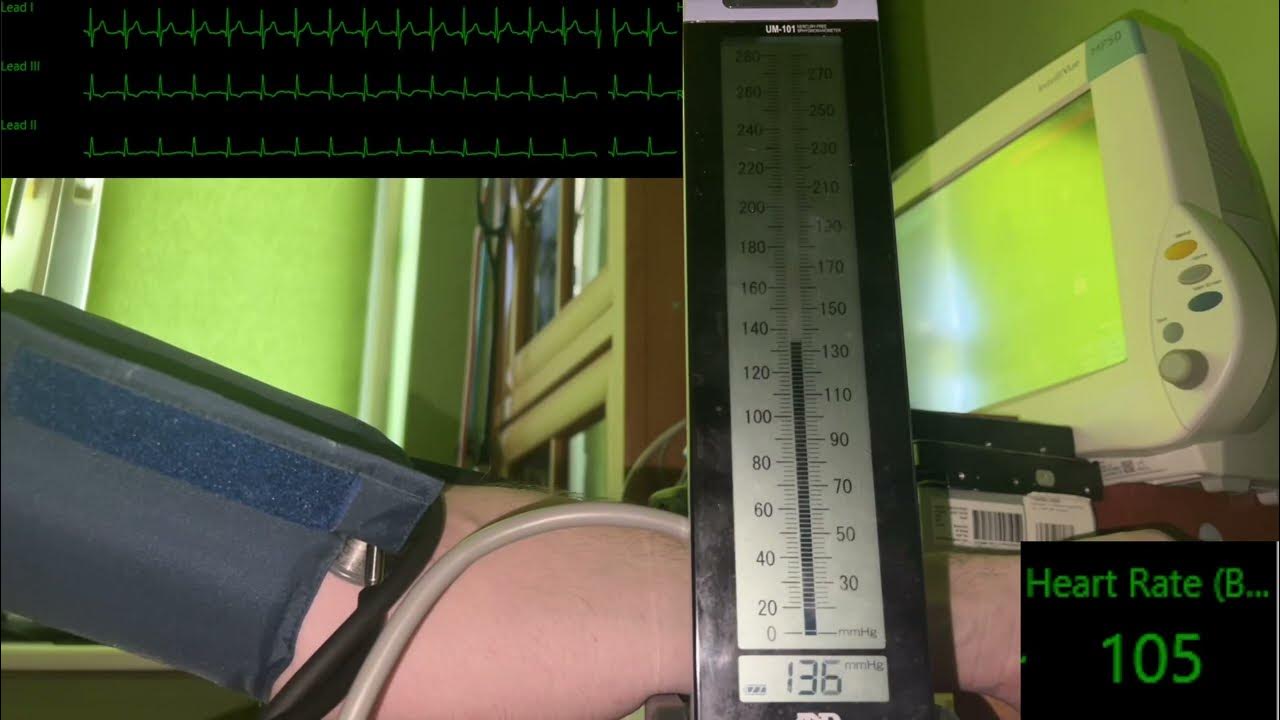 Manual Blood Pressure Examination /w Tachycardia and Irregular