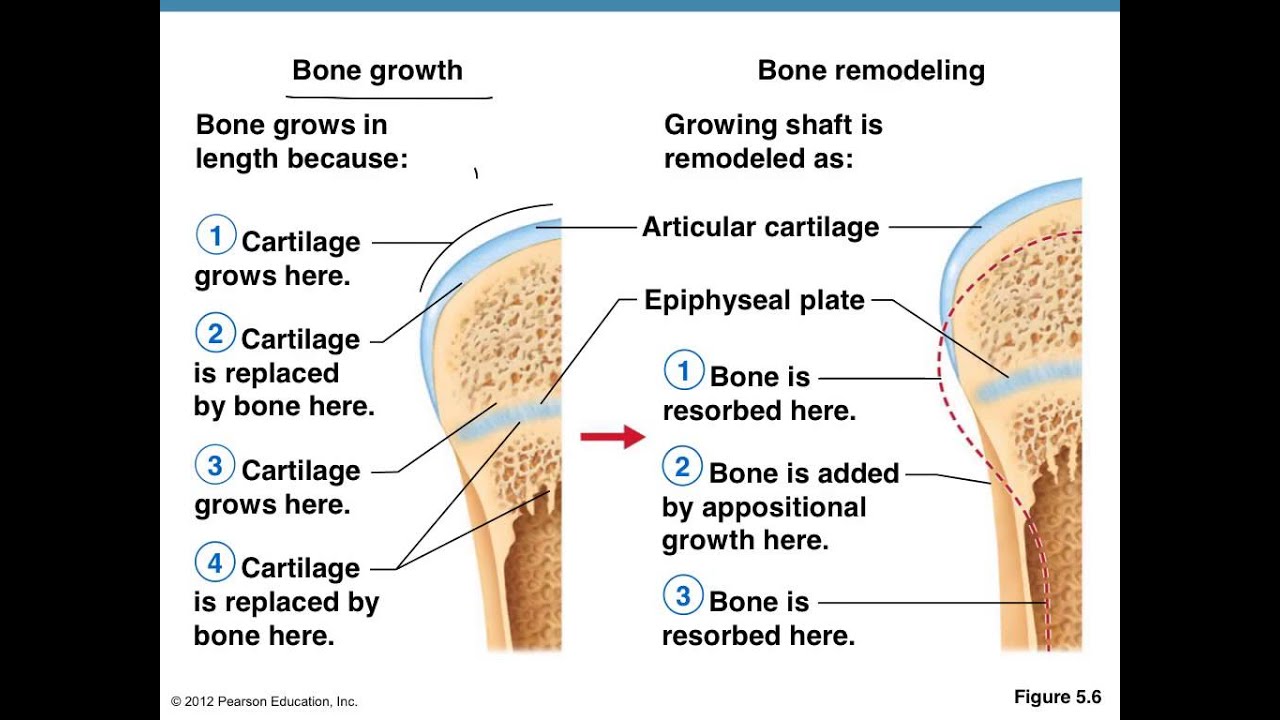 030 Bone Formation Fractures And Joints Lessons Blendspace