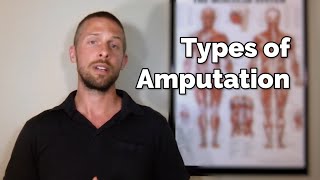 Types Of Amputation