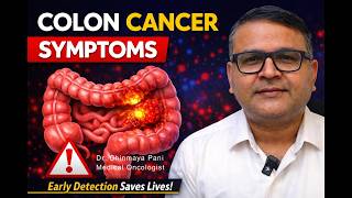 Know The Colon Cancer  Symptoms – Dr. Chinmay Pani - Medical Oncologist