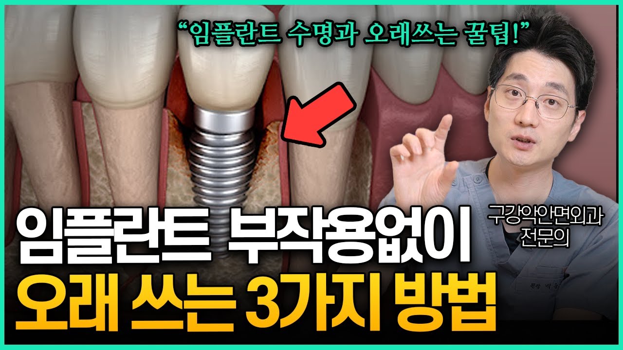 환자들은 모르는 임플란트 수명과 부작용 없이 오래 쓰는 3가지 방법!