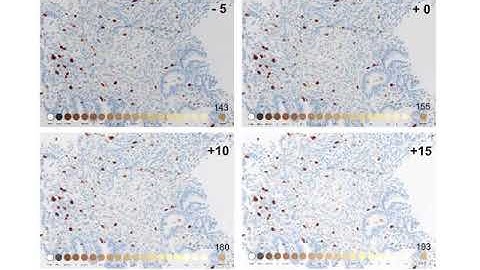 Pathology Equipment, Pathlab diagnostics, leica bond ihc stainer www.ihc-prs.com