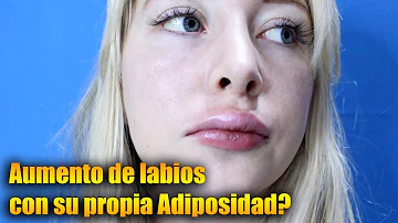 ¿Se puede poner grasa en los labios?