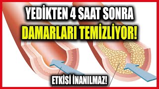 Yedikten 4 Saat Sonra Damarları Temizliyor Kalp Krizini Önlüyor