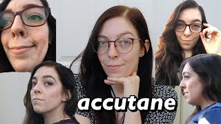 i was on Accutane for 10 months