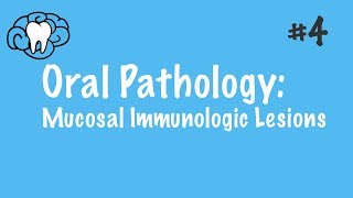 Oral Pathology | Mucosal Immunologic Diseases | INBDE, ADAT screenshot 5