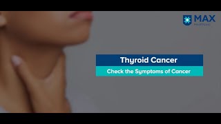 Symptoms of thyroid cancer explained