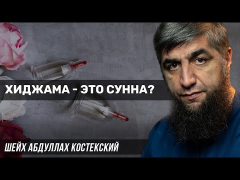 Хиджама - это сунна?