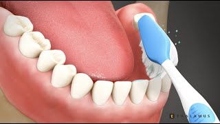 Proper Tooth Brushing Technique Australian Accent screenshot 3
