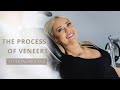 The process of veneers  dental boutique